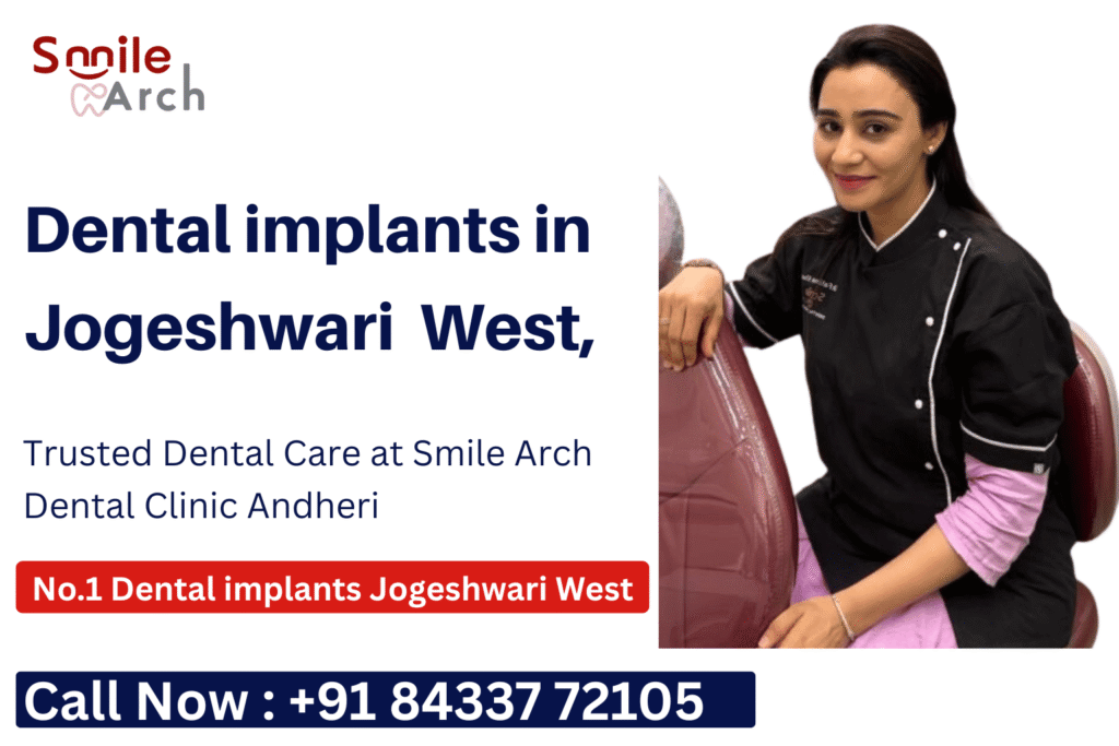Dental implants Clinic Jogeshwari West, Dental implant cost Jogeshwari West, Teeth implants clinic Jogeshwari West, Best implant dentist near Jogeshwari West, Full mouth dental implants Jogeshwari