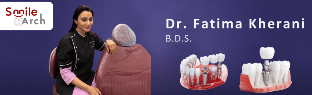 Dental implants Clinic Jogeshwari West, Dental implant cost Jogeshwari West, Teeth implants clinic Jogeshwari West, Best implant dentist near Jogeshwari West, Full mouth dental implants Jogeshwari