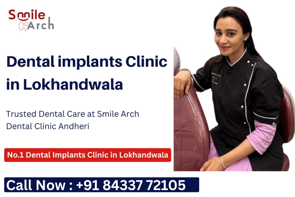 Dental implants clinic in Lokhandwala, Dental implant cost Lokhandwala, Teeth implants clinic Lokhandwala, Best implant dentist near Lokhandwala,