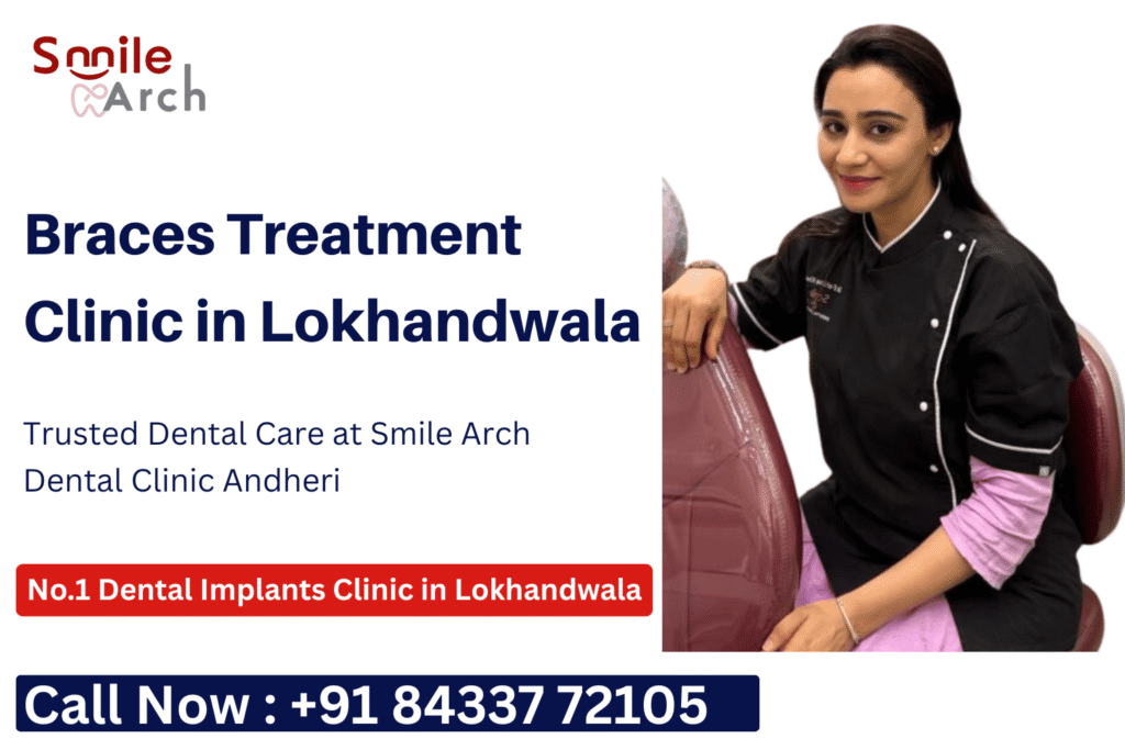 Braces Treatment in Lokhandwala, Braces Treatment Cost in Lokhandwala, Braces Treatment clinic Lokhandwala