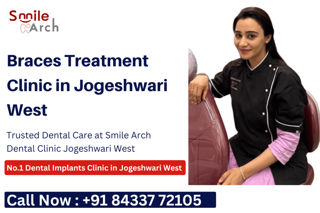 Braces Treatment in Jogeshwari West, Braces Treatment Cost in Jogeshwari West, Braces Treatment clinic Jogeshwari West