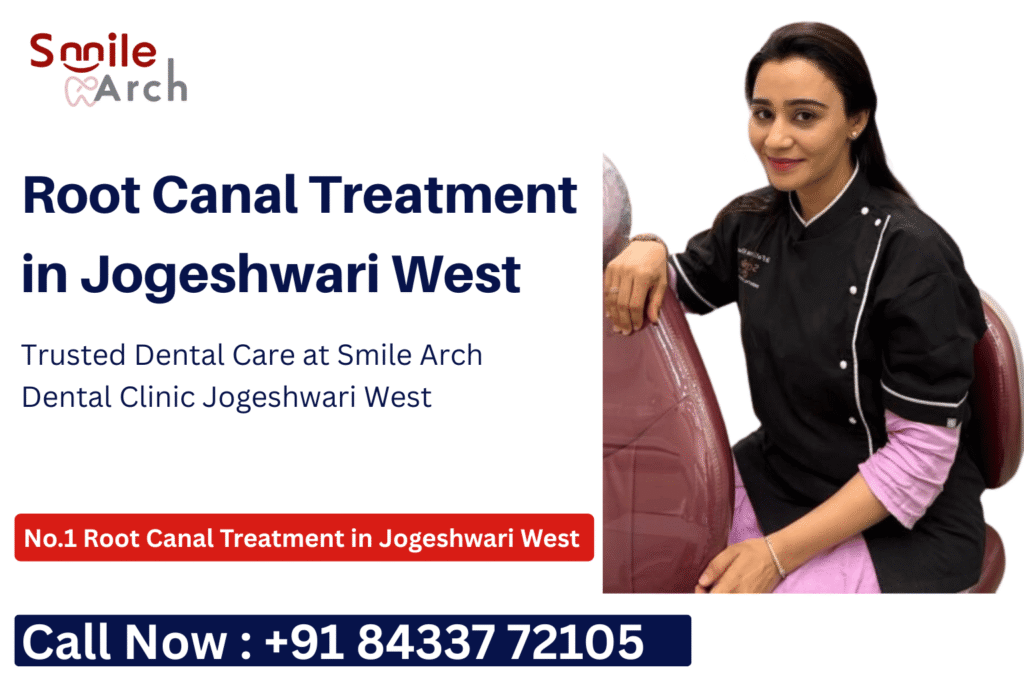 root canal treatment in Jogeshwari West, root canal treatment cost Jogeshwari West, root canal treatment clinic Jogeshwari West, Best root canal dentist near Jogeshwari West,